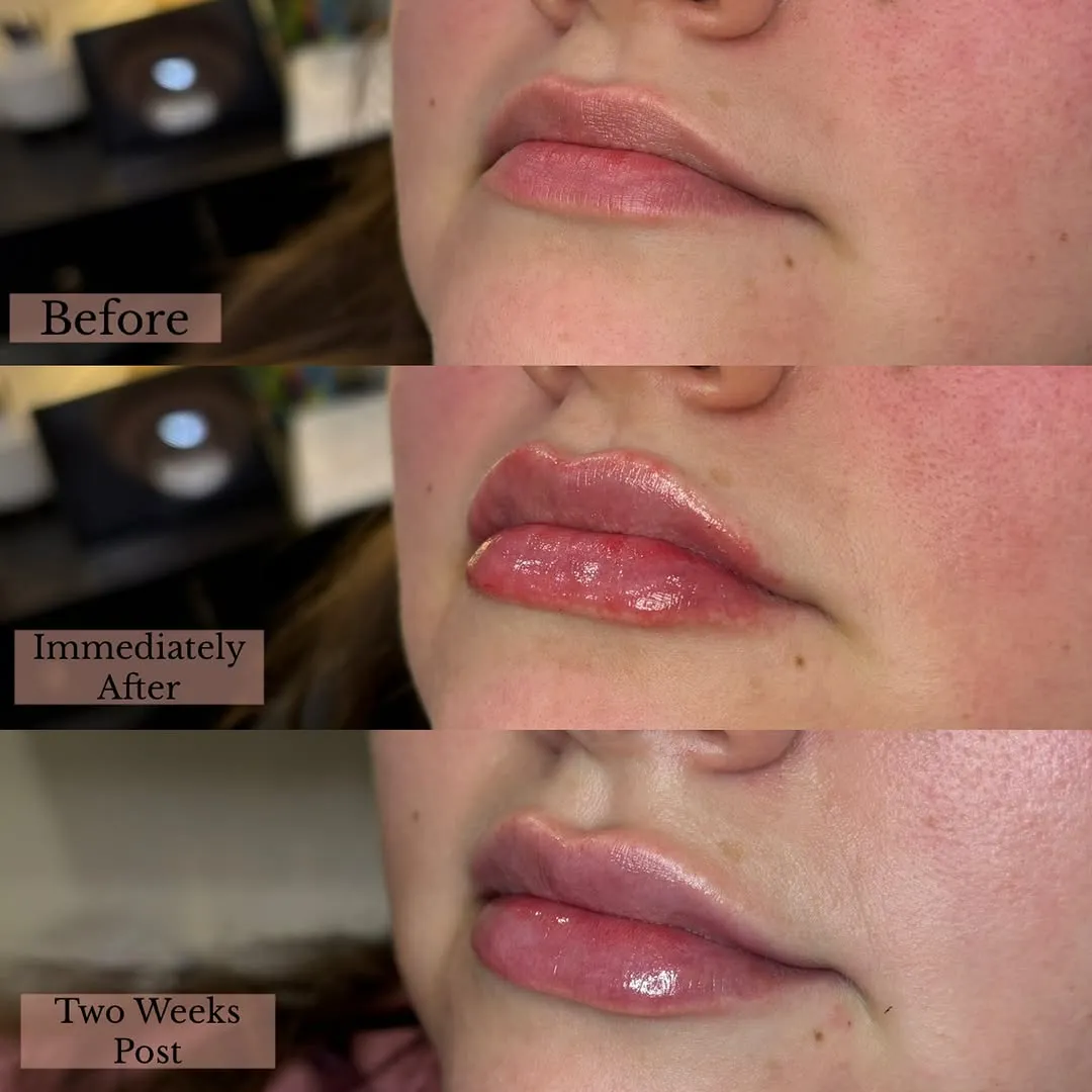 Treatment results — before and after