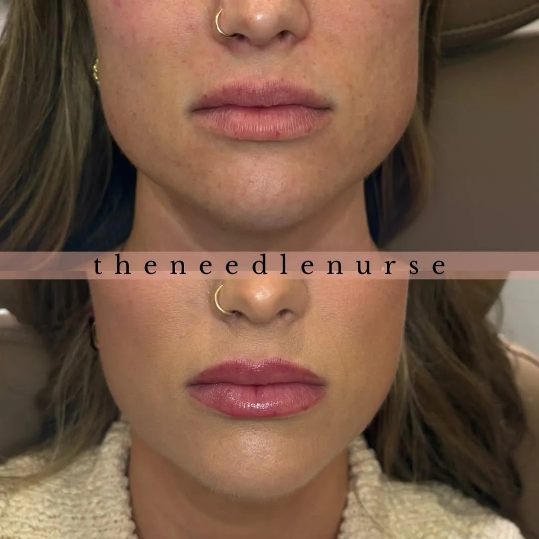 Treatment results — before and after
