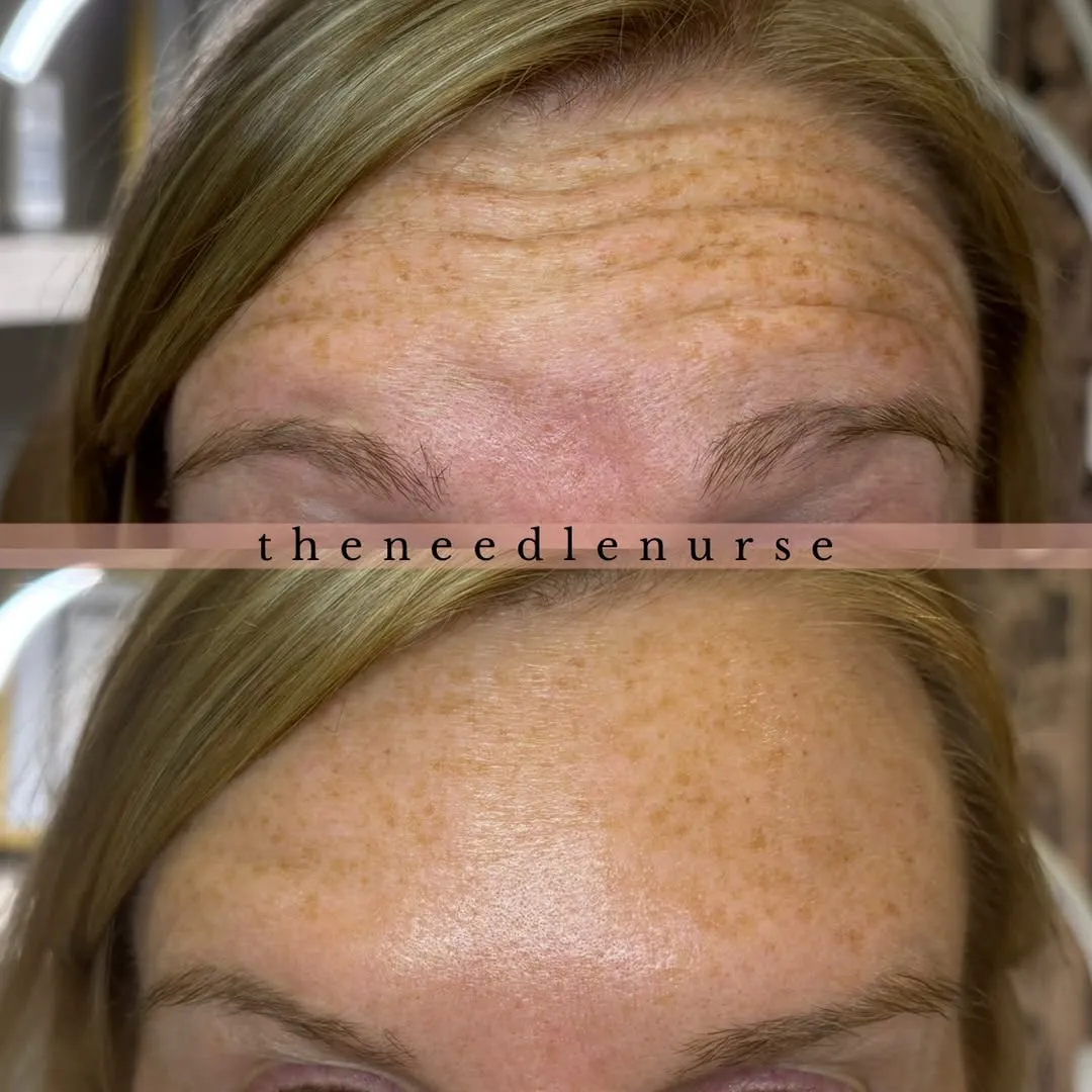 Treatment results — before and after