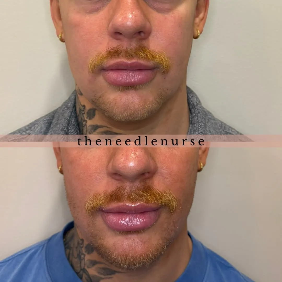 Treatment results — before and after