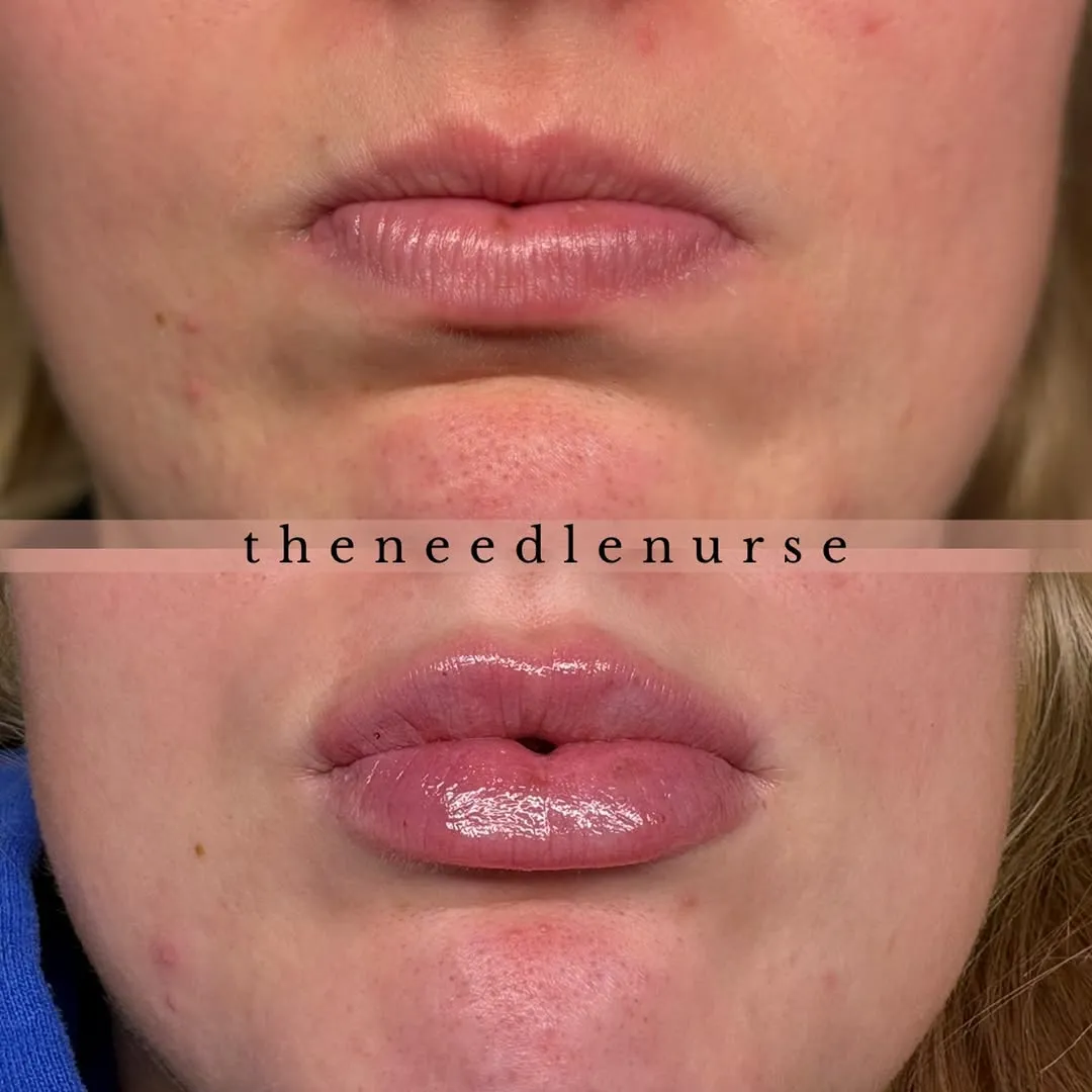 Treatment results — before and after