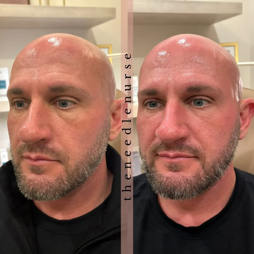 Treatment results — before and after